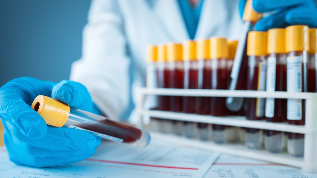 FDA, Kolon Kanseri Tarama Testine Onay Verdi